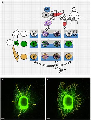 Human Platelet Lysate Acts Synergistically With Laminin to Improve the Neurotrophic Effect of Human Adipose-Derived Stem Cells on Primary Neurons in vitro